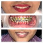 Befor and after image